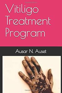 Vitiligo Treatment Program: Learn How to Heal Your Melanin Naturally
