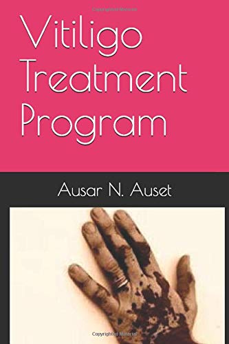 Vitiligo Treatment Program: Learn How to Heal Your Melanin Naturally by Ausar N Auset
