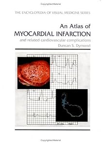 An Atlas of Myocardial Infarction and Related Cardiovascular Complications (Encyclopedia of Visual Medicine Series) by D.S. Dymond