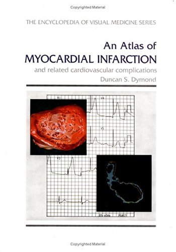 An Atlas of Myocardial Infarction and Related Cardiovascular Complications (Encyclopedia of Visual Medicine Series) by D.S. Dymond