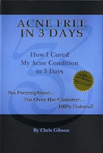 Acne Free in 3 Days: How I Cured My Acne Condition in 3 Days