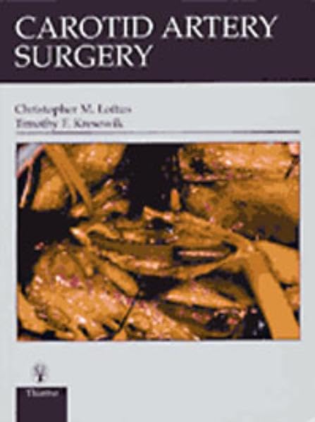 Carotid Artery Surgery by Christopher M. Loftus