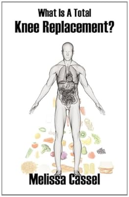 What Is A Total Knee Replacement?