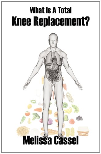 What Is A Total Knee Replacement? by Melissa Cassel