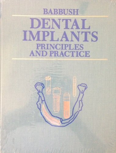 Algopix Similar Product 15 - Dental Implants: Principles and Practice