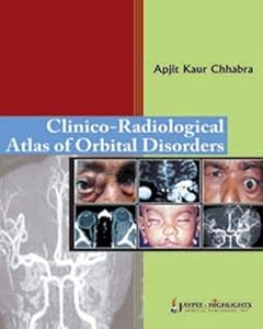 Clinico-Radiological Atlas of Orbital Disorders by Shivaraja Shankara YM