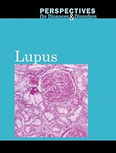 Lupus (Perspectives on Diseases & Disorders)