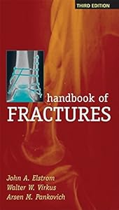 Handbook of Fractures, Third Edition by John A. Elstrom