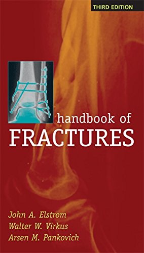 Handbook of Fractures, Third Edition by John A. Elstrom