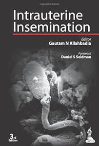 Intrauterine Insemination by by U. Müller and W. Franke
