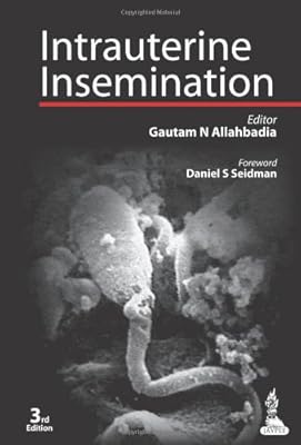 Intrauterine Insemination