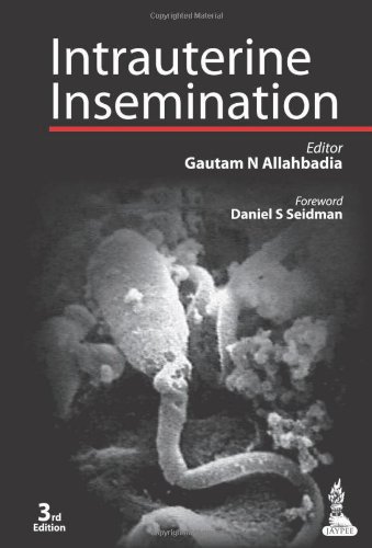 Intrauterine Insemination by by U. Müller and W. Franke