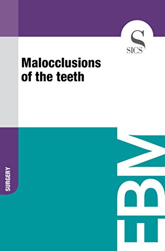 Algopix Similar Product 2 - Malocclusions of the Teeth