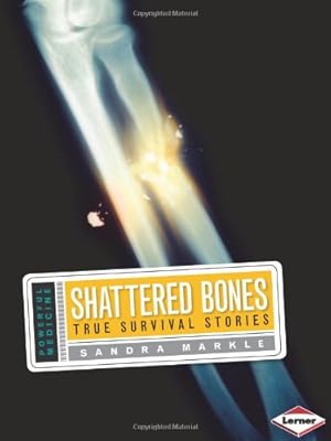 Shattered Bones: True Survival Stories