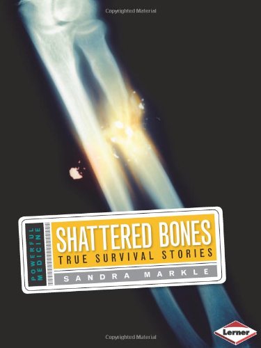 Shattered Bones: True Survival Stories by Sandra Markle