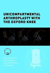Unicompartmental Arthroplasty with the Oxford Knee