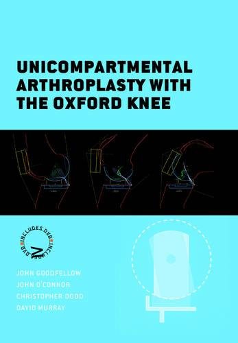 Unicompartmental Arthroplasty with the Oxford Knee by John Goodfellow