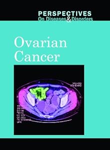 Ovarian Cancer