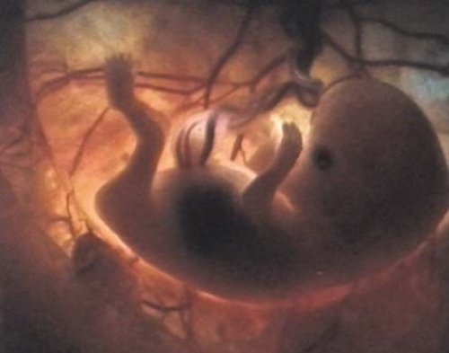 Ein Leben entsteht - Zeugung, Entwicklung, Geburt - DVD - Lehrfilm für Unterricht und Ausbildung - Hagemann 180234 - Einzellizenz - 