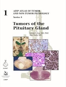 Tumors of the Pituitary Gland (AFIP Atlas of Tumor and Non-Tumor Pathology, Series 5) by Sylvia L. Asa (author)