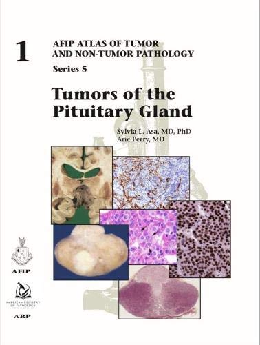 Tumors of the Pituitary Gland (AFIP Atlas of Tumor and Non-Tumor Pathology, Series 5) by Sylvia L. Asa (author)