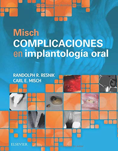 Algopix Similar Product 17 - MISCH COMPLICACIONES EN IMPLANTOLOGIA