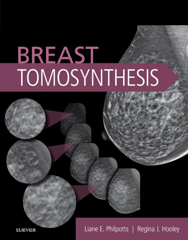 Breast Tomosynthesis by Liane E Philpotts