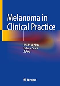 Melanoma in Clinical Practice by Rhoda M. Alani