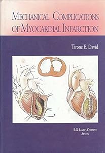Mechanical Complications of Mycocardial Infarction by M.D. David, Tirone E.