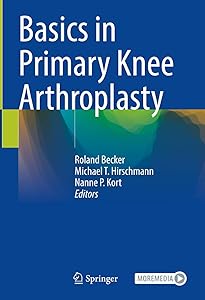 Basics in Primary Knee Arthroplasty by Roland Becker