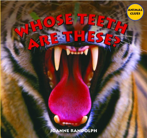 Whose teeth are these? by Joanne Randolph