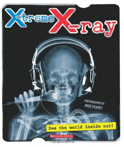X-ray