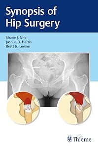 Synopsis of Hip Surgery by Shane J. Nho