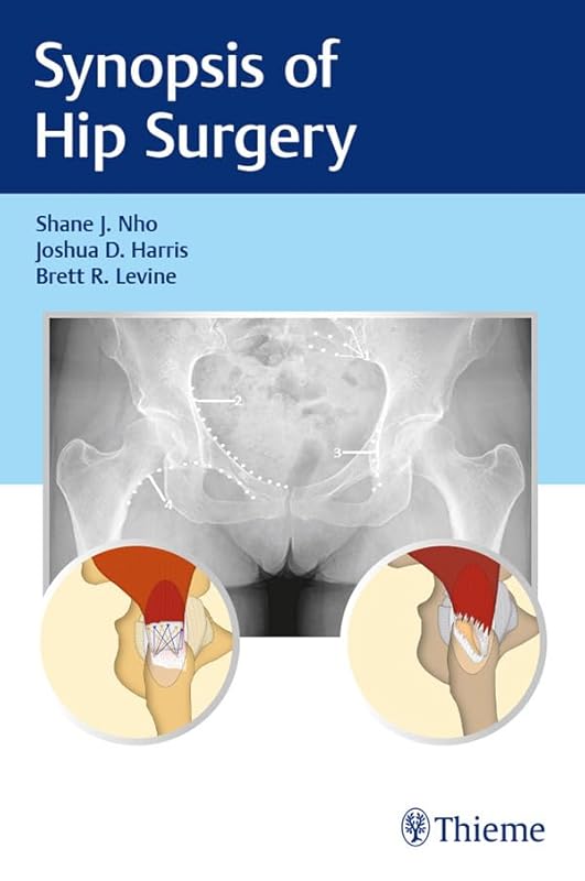 Synopsis of Hip Surgery by Shane J. Nho