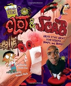 Clot & Scab: Gross Stuff about Your Scrapes, Bumps, and Bruises (Gross Body Science)