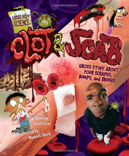 Clot & Scab: Gross Stuff about Your Scrapes, Bumps, and Bruises (Gross Body Science) by Kristi Lew