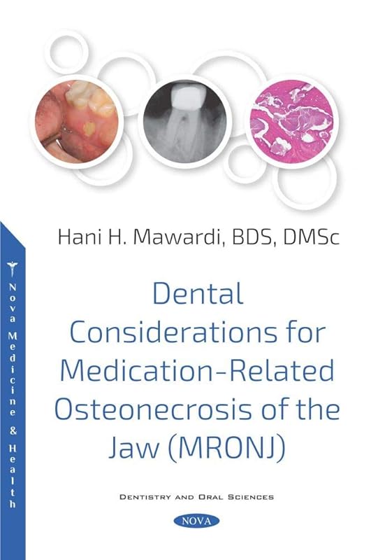 Dental Considerations for Medication-Related Osteonecrosis of the Jaw (MRONJ) (Denistry and Oral Sciences) by Hani H. Mawardi