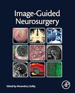 Image-Guided Neurosurgery by Alexandra J. Golby