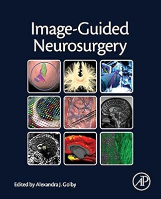 Image-Guided Neurosurgery