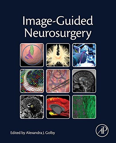 Image-Guided Neurosurgery by Alexandra J. Golby