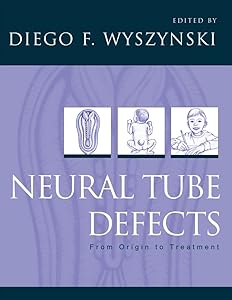 Neural Tube Defects: From Origin to Treatment by Diego F. Wyszynski