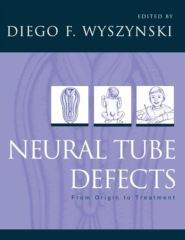 Neural Tube Defects: From Origin to Treatment by Diego F. Wyszynski