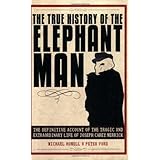 The True History of the Elephant Man
