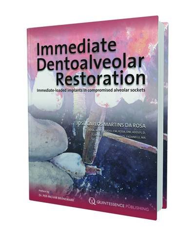 Algopix Similar Product 20 - Immediate Dentoalveolar Restoration