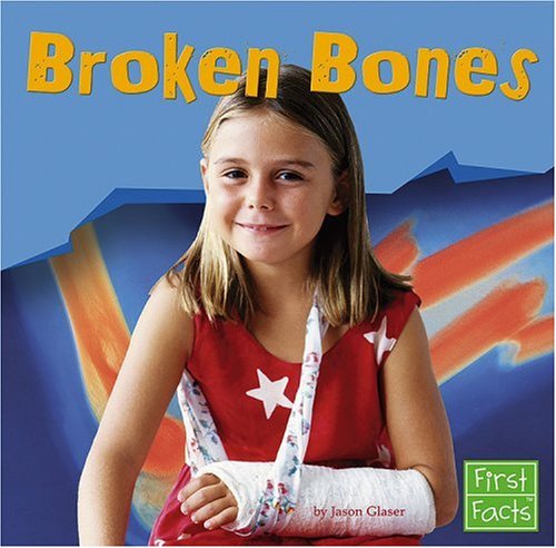 Broken Bones (First Facts) by Jason