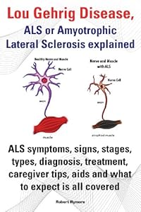 Lou Gehrig Disease, ALS or Amyotrophic Lateral Sclerosis Explained. ALS Symptoms, Signs, Stages, Types, Diagnosis, Treatment, Caregiver Tips, AIDS and by Robert Rymore