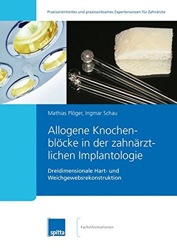 Algopix Similar Product 13 - Allogene Knochenblcke in der