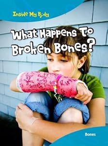 What Happens to Broken Bones?