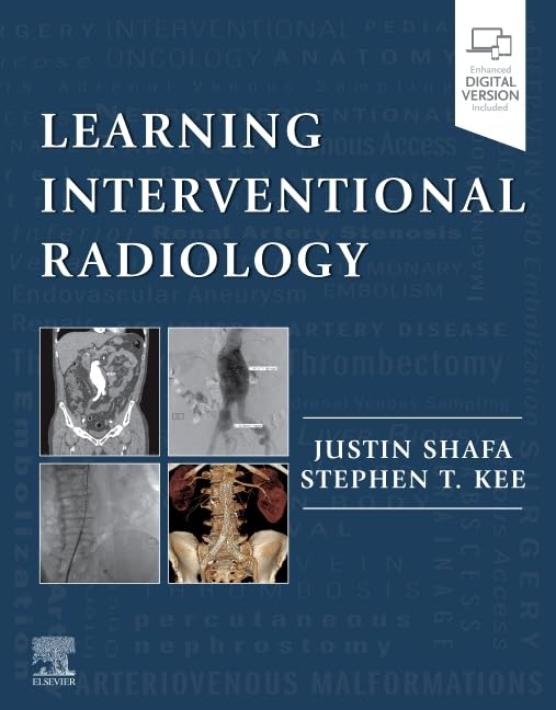 Learning Interventional Radiology by Justin Shafa