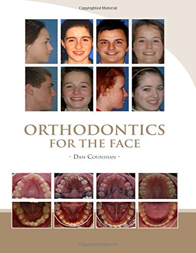 Photodynamic Therapy of Diseases of the Head and Neck